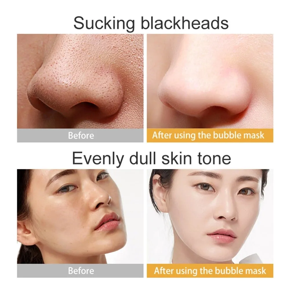 "(1 PACK) Deep Cleansing Black Sea Salt Bubble Facial Mask: Pure Moisturization for a refreshed and revitalized skin"