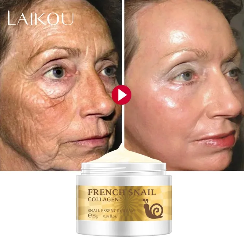 "Snail Secretion Filtrate Cream with Hyaluronic Acid: A Moisturizer for Anti-Wrinkle and Anti-Aging benefits"